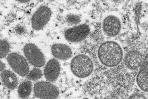 Rio Grande do Sul confirmou mais um caso de monkeypox