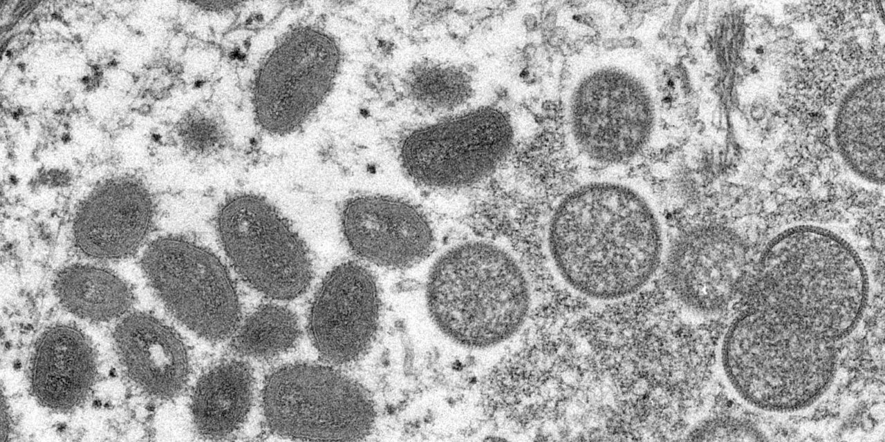 Rio Grande do Sul confirmou mais um caso de monkeypox
